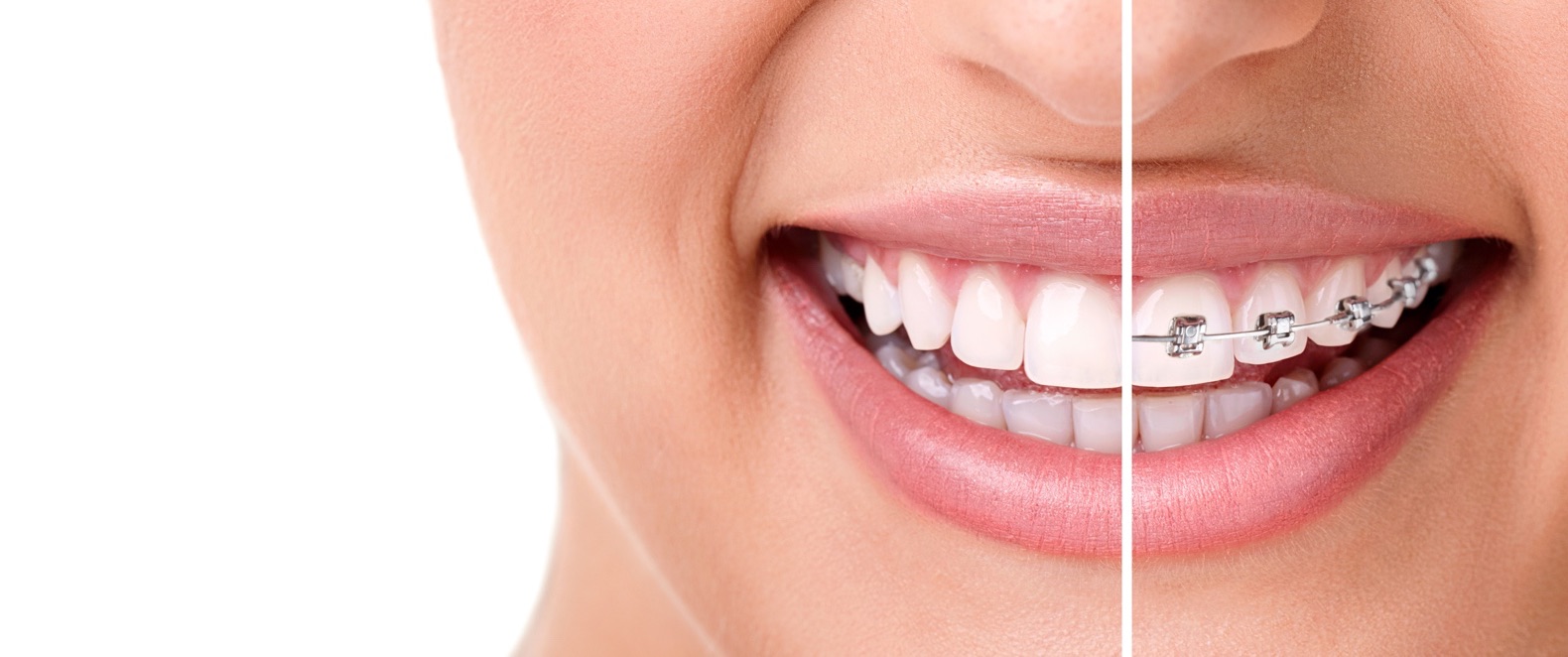 Orthodontics Image